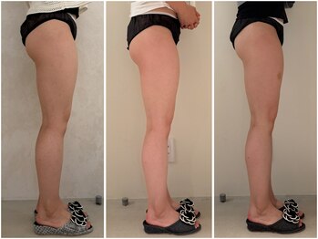 カレンジェビューティー(CarengeBeauty)/ヒップアップ