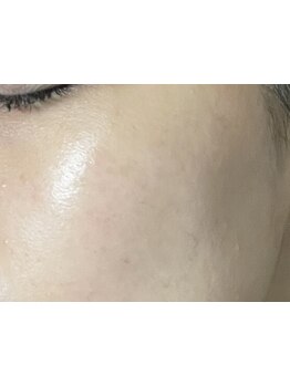 お肌をきれいにしたい