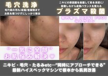 バルディーナ(BALDINA)