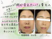 ラミーユ(La Miu)の雰囲気(最初は2週間に一回の集中ケアで改善が早いです!山科椥辻東野)