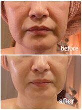 アルコイリス(Arco iris)/何歳から始めても遅くない！