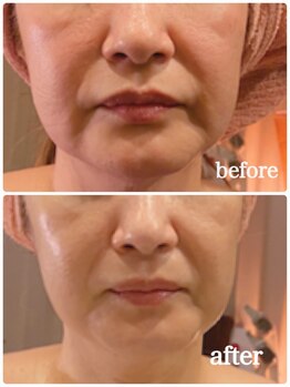 アルコイリス(Arco iris)/何歳から始めても遅くない!