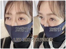 メルシーアイ アカナベテン(Merci Eye 茜部店)の雰囲気（LED 3Dボリュームラッシュ80束の施術Before After）