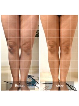 ハナン(Hanan)/特許波形ナノカレント