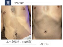 メンズメイド(Mens'Made)/before /after