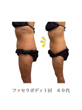 コーラル(Coral)/ファセラボディ（60代施術結果）