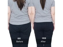 継みの雰囲気（年々お尻が大きくなると言うお悩みを改善に導く）