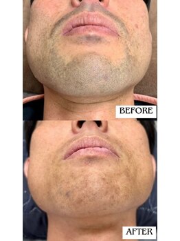 バディーズ(BUDDieS)/30代