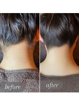 エピナス 大和店/光脱毛＋ブラジリアンワックス