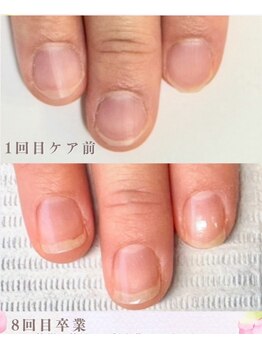 エン(en)/最強のネイルケアコース