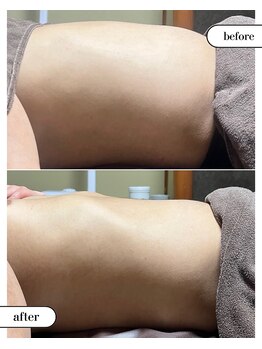 シト(Shito)の写真/筋肉の深部加熱で緩めて整う！姿勢まで美しく引き締まる美ボディラインへ