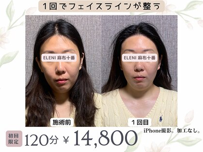 エレーニ 麻布十番(ELENI)の写真