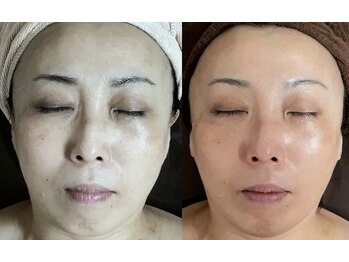 メディカルサロン かとれあ/7ヵ月で！