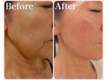 トータルビューティサロン クイーン(Queen)/5年前よりも若返っている♪