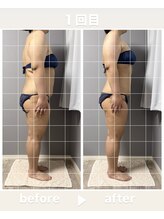 メゾン ド クロエ(Maison de Chloe)/CHLOE式パーソナル痩身