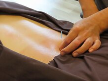 鍼灸整骨院わか/