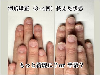 クウ(KUU)/もっと綺麗に?それとも卒業?