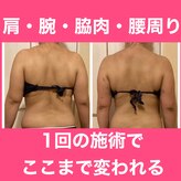 ヨサパーク メルシャン(YOSA PARK merci_an)