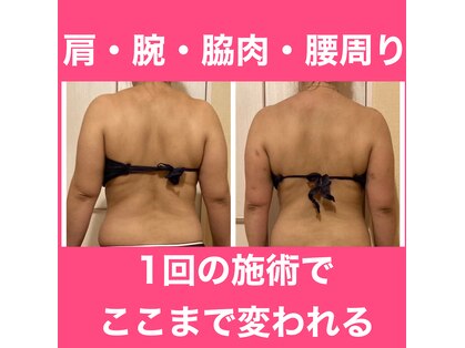 ヨサパーク メルシャン(YOSA PARK merci_an)の写真