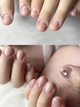 エンチューン(en.tune)の写真/爪が割れる、深爪や噛む癖、むしり癖…etc あらゆる爪の悩みを解消するための最適なサロンがここに★