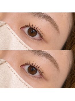 アン(UNE)の写真/高い技術力&カウンセリング力で貴方のお悩みを解決♪【☆新規限定☆パリジェンヌorラッシュリフト¥4800】