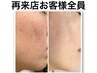 悩んだらこれ【贅沢セレクト】一緒にあなたの肌悩みに合わせて選べる60分