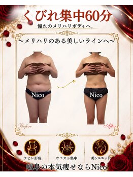 ニコ 岐南本店(Nico)の写真/本気痩せ専門店|くびれをつくるウエスト集中60分