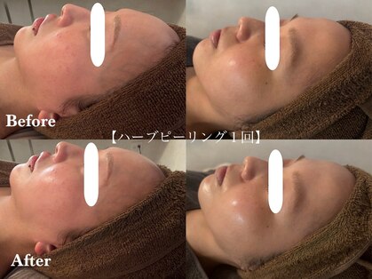 アピュルテ(A purete')の写真