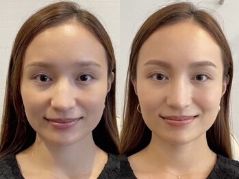 アナスタシア ミアレ 名古屋栄三越店の写真/名古屋栄/眉専門/眉にこだわり22年。自分らしさを大切にする女性へ本来の美しさが際立つ眉をご提案◎