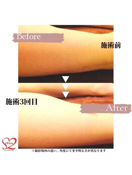 オリオンドットエスツー(Orion.S2)/【Before→After】