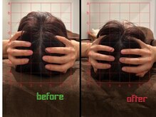 イチ(ichi)/ヘッドスパ1回の変化