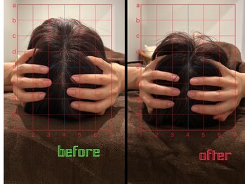 イチ(ichi)/ヘッドスパ1回の変化