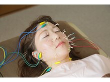 みずのえ鍼灸院/美容鍼は全て電気鍼(EMS)付です!