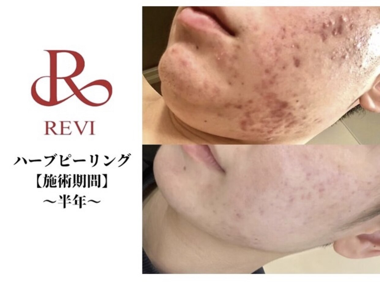 レヴィア 東大宮店(REVIA)｜ホットペッパービューティー