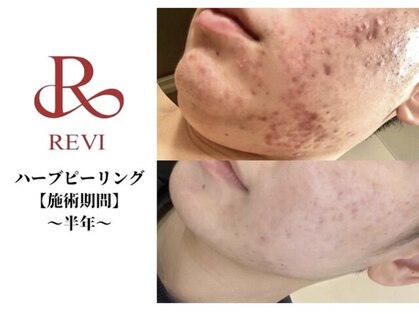 レヴィア 東大宮店(REVIA)の写真