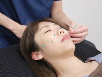 藤接骨院 浜松高林院の写真/実績豊富!!初めての方も安心◎美肌&小顔を叶えるオーダーメイド美容鍼や辛い腰痛を改善する鍼灸施術が人気!
