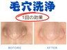 ニョキニョキスペシャル《洗顔＋吸引＋パック》¥12,000→¥8,500