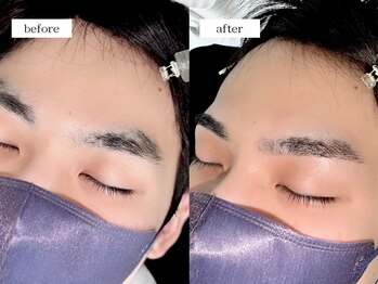 エムドット(m.)/メンズアイブロウワックス脱毛