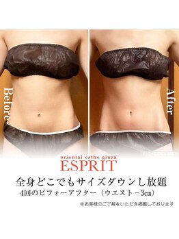 エスプリ 銀座店/お腹スリム・くびれ体験銀座