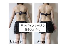 プラチナ ヒーリング(PLATINUM HEALING.)の雰囲気（取れにくい背中のむくみ改善☆代謝がアップし、ダイエット効果♪）