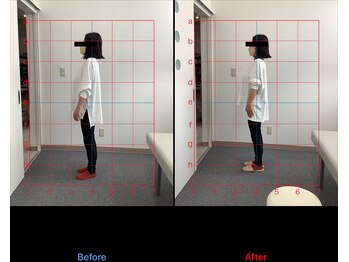 リード整骨院(LEAD整骨院)/産後の腰痛#産後の骨盤矯正#膝痛