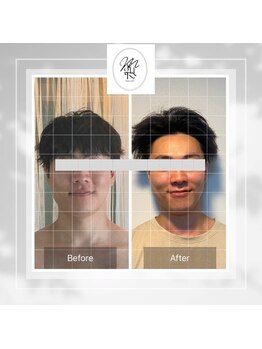 メグルサロン 自由が丘(MeguruSalon)/小顔矯正