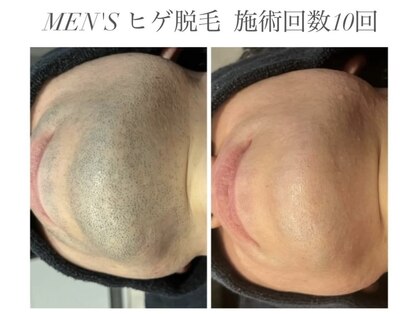 エミナル(EMINAL)の写真