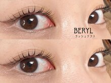 ベリル(BERYL)/