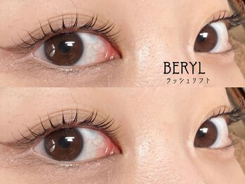 ベリル(BERYL)/