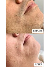 バディーズ(BUDDieS)/40代