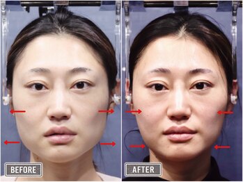 さつま骨格矯正 表参道青山院/歪み小顔矯正＋骨盤矯正