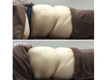 アヤエステティックサロン 綱島店(AYA)/ポッコリお腹もスッキリ♪