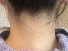 ミラ 本厚木(Mira.)/うなじワックス　before