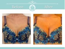 美人バスト 新潟店/ 【バストアップ★育乳】症例